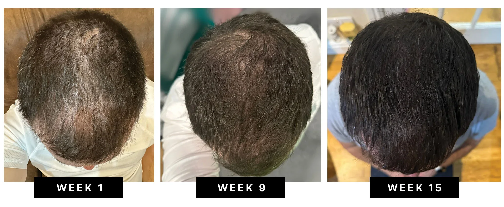 Top-down photos of one customer's hair at week 1, week 9 and week 15 of using HUSSSH Hair Therapy Shampoo