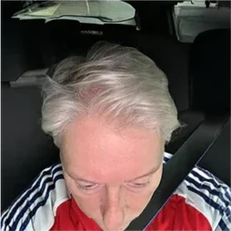 Elaine's hairline after using HUSSSH, looking fuller at the front