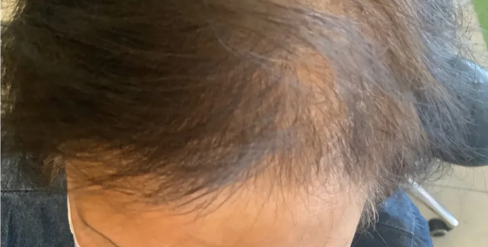 The same part line after using HUSSSH, looking fuller
