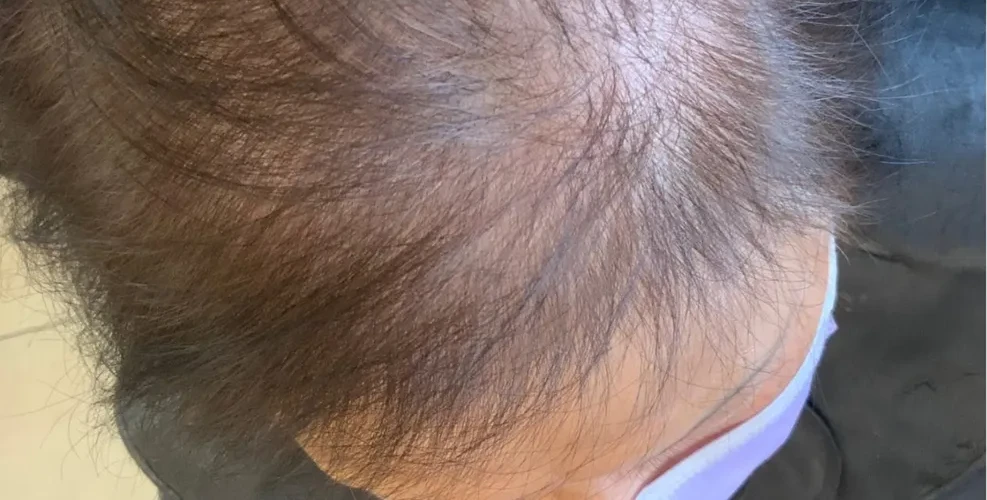 A customer's part line before using HUSSSH