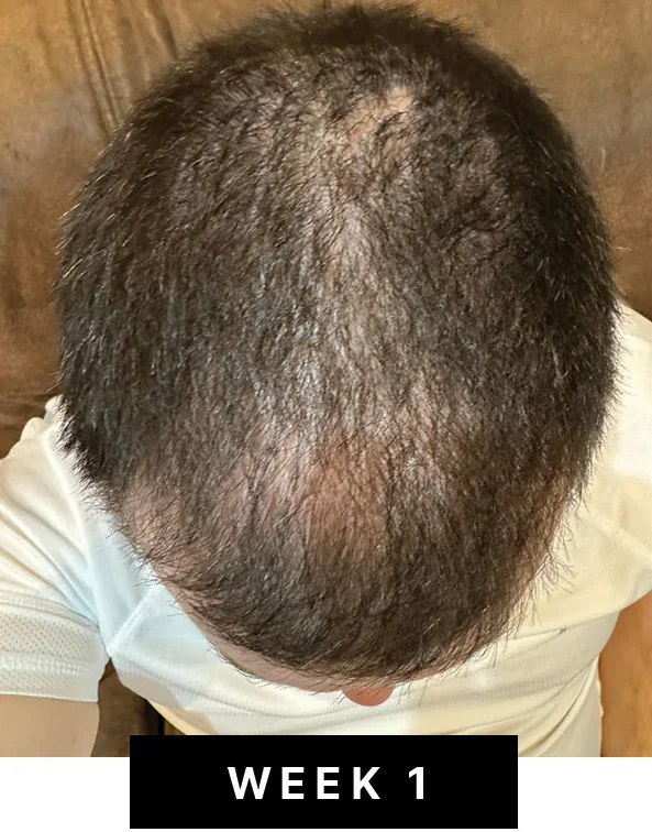 Week 1 density